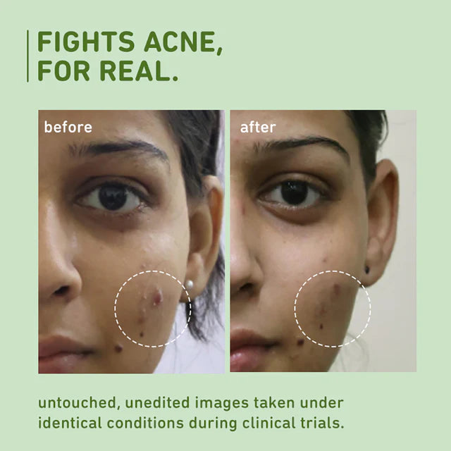 Plum - Green Tea Pore Cleansing Face Wash with Glycolic Acid (150ml)