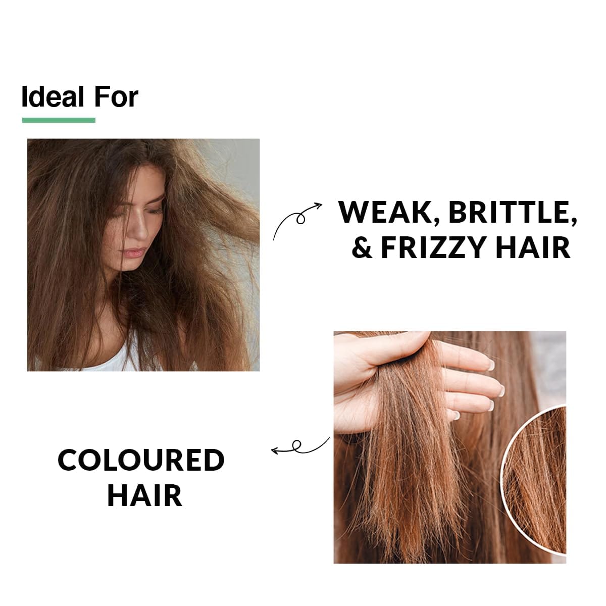 Fixderma - Kairfoll 15% Red Onion Conditioner with Castor Oil for Hair Growth (200mL)