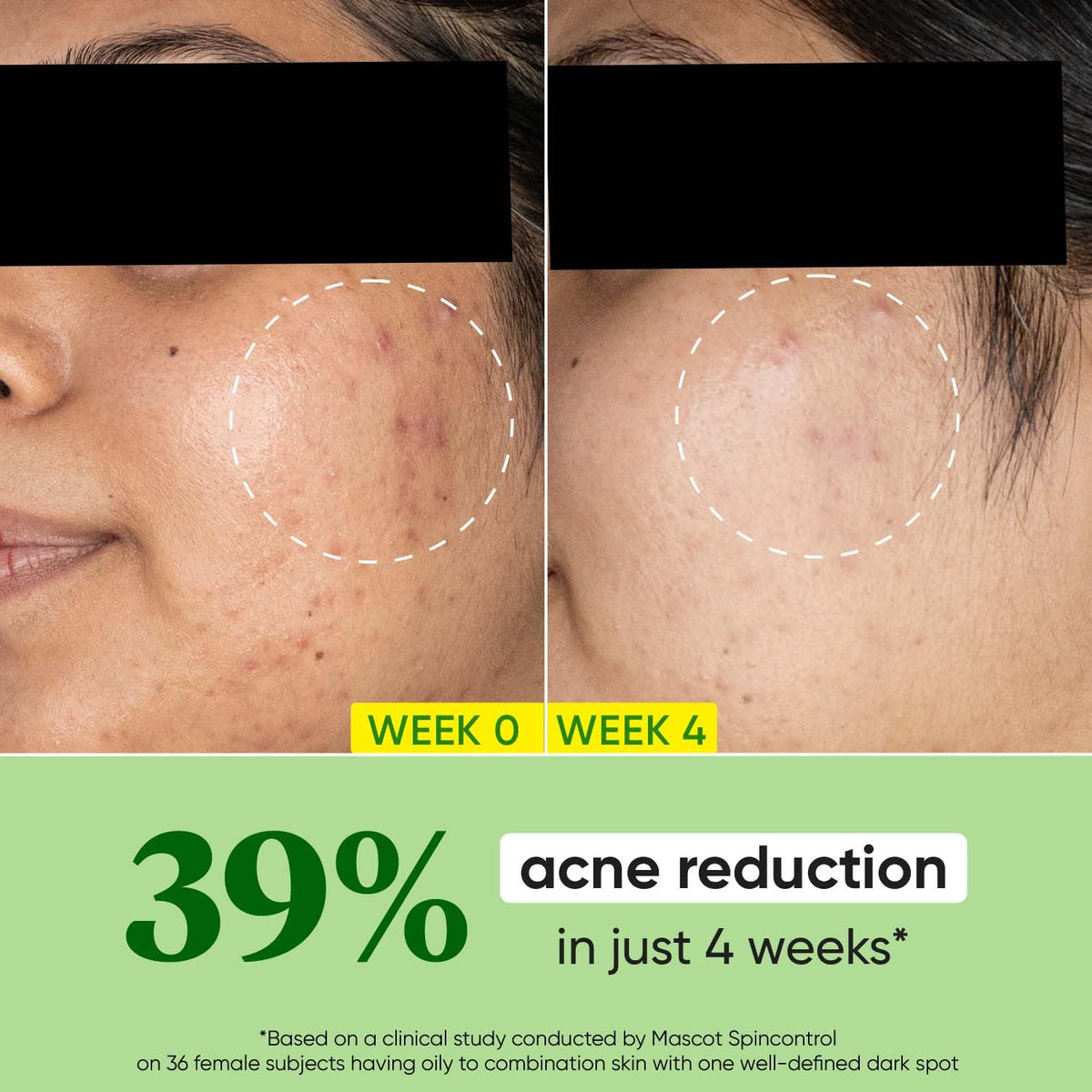 Dot & Key - Powerful Acne Fighter: Infused with Cica (Centella Asiatica)