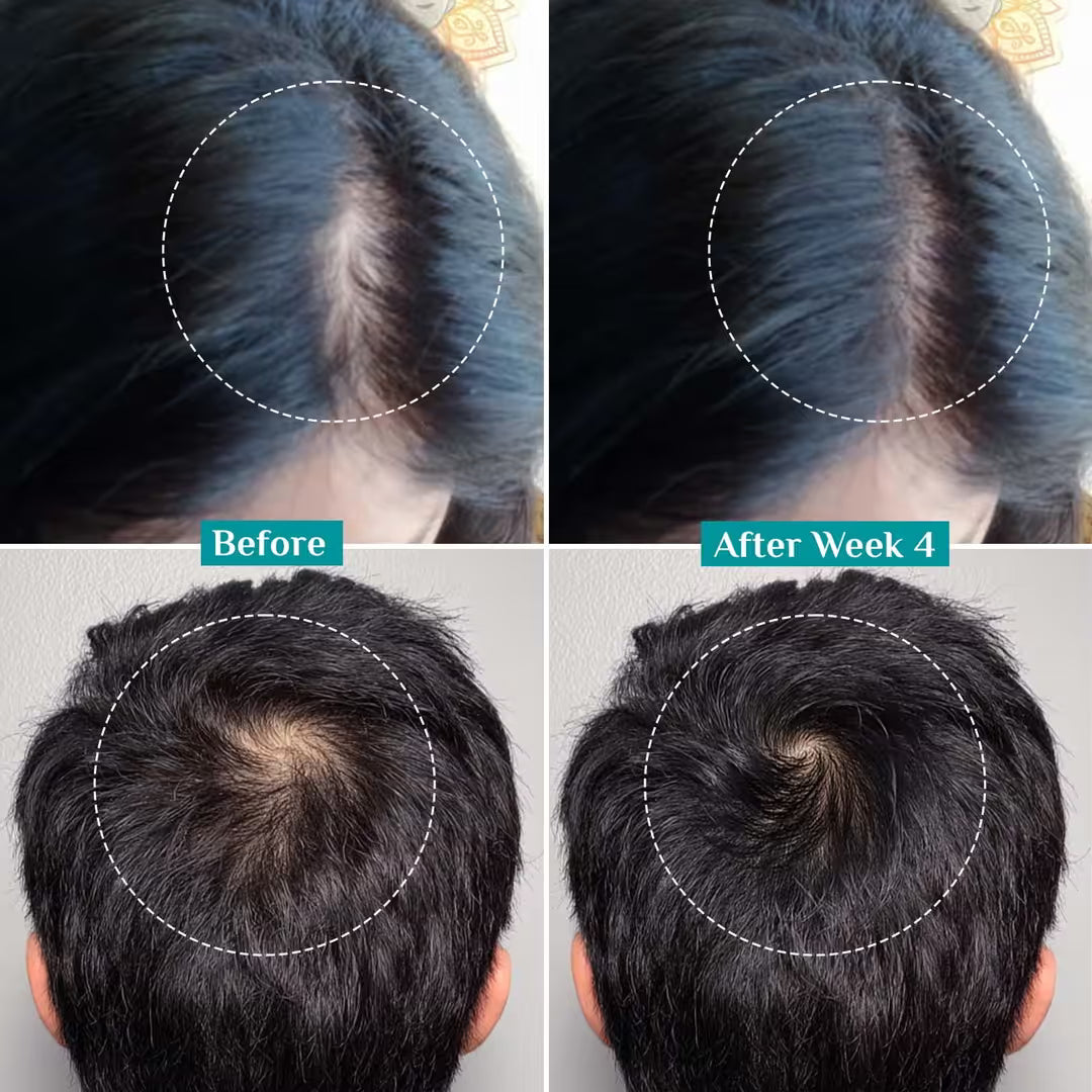 Pilgrim - Advanced Hair Growth Serum Roll-On (25ml)