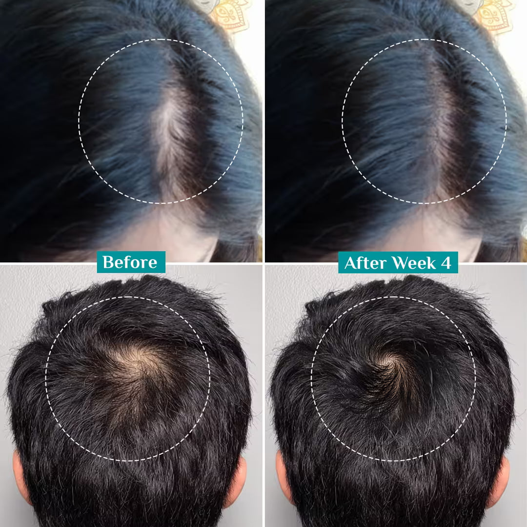 Pilgrim - Advanced Hair Growth Serum (100ml)