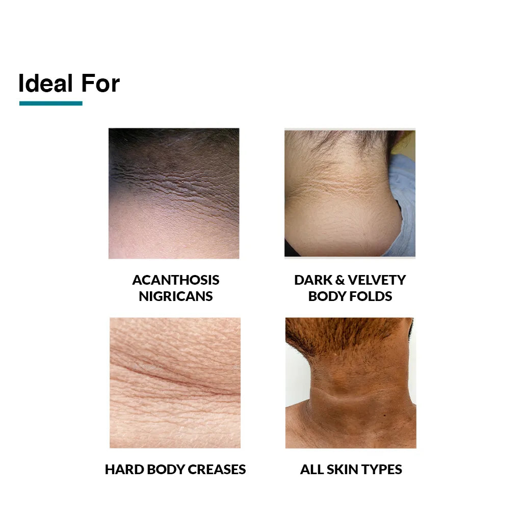 Fix Derma - Nigrifix Cream (50g)