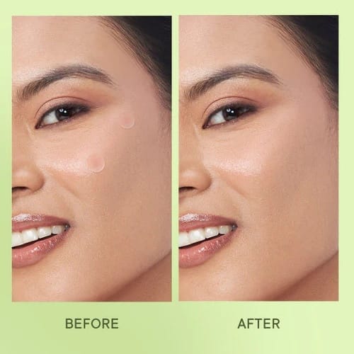 Quench - Matcha Tea Clarifying Spot Patches With Salicylic Acid And Niacinamide (12 Patches)