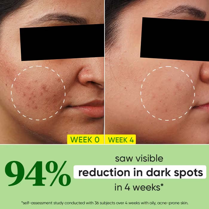Dot & Key 10% Niacinamide + Cica Face Serum For Oily, Acne Prone Skin & Dark Spots Reduction (30ml)