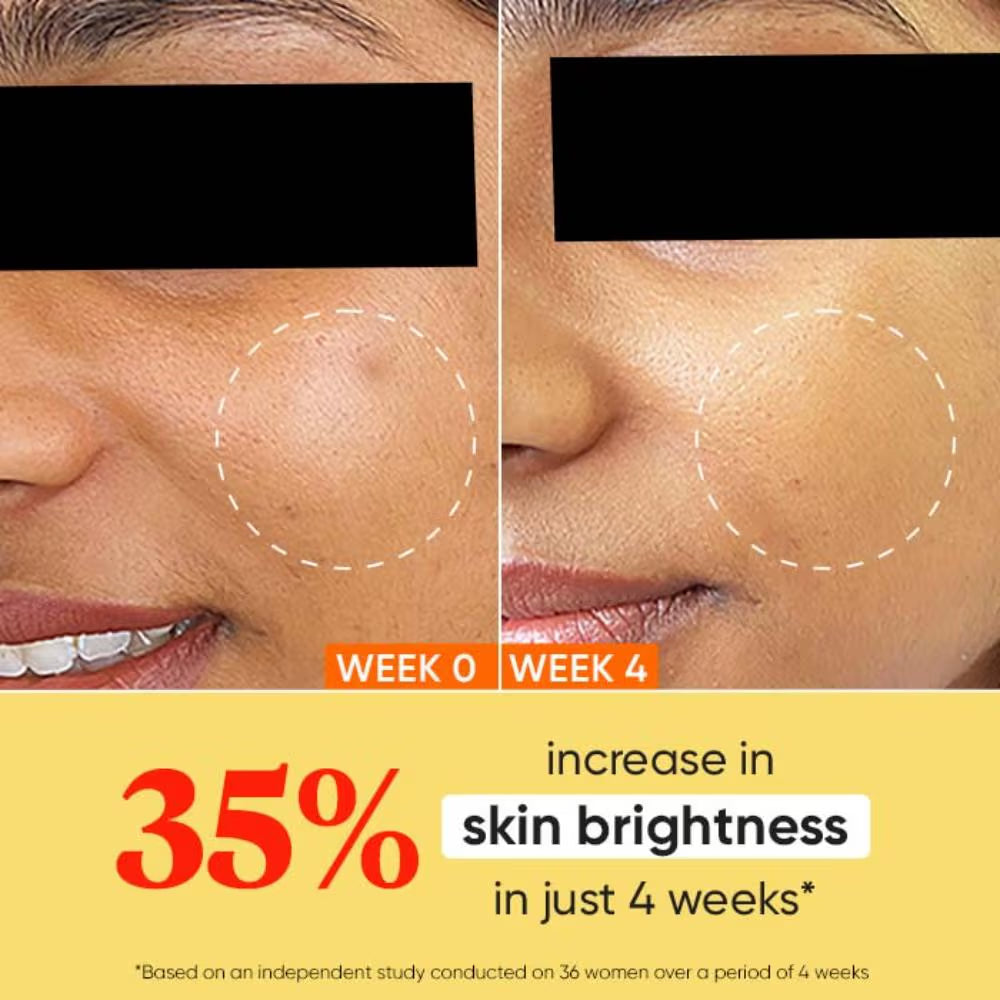 Dot & Key Vitamin C + E Super Bright Face Moisturizer For Glowing Skin, Fades Dark Spots (60ML)