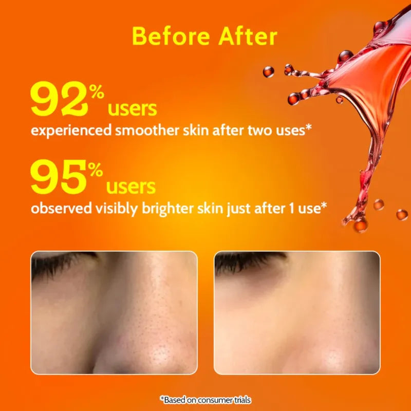 Chemist At Play – Exfoliating Peel (30ml)