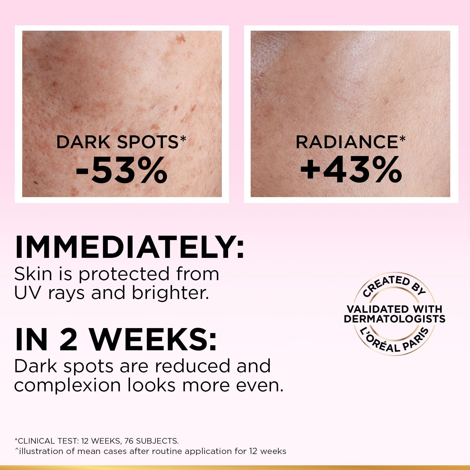 Loreal Paris - Glycolic Bright Anti Dark Spot Daily UV Fluid Spf 50+ (50ML)