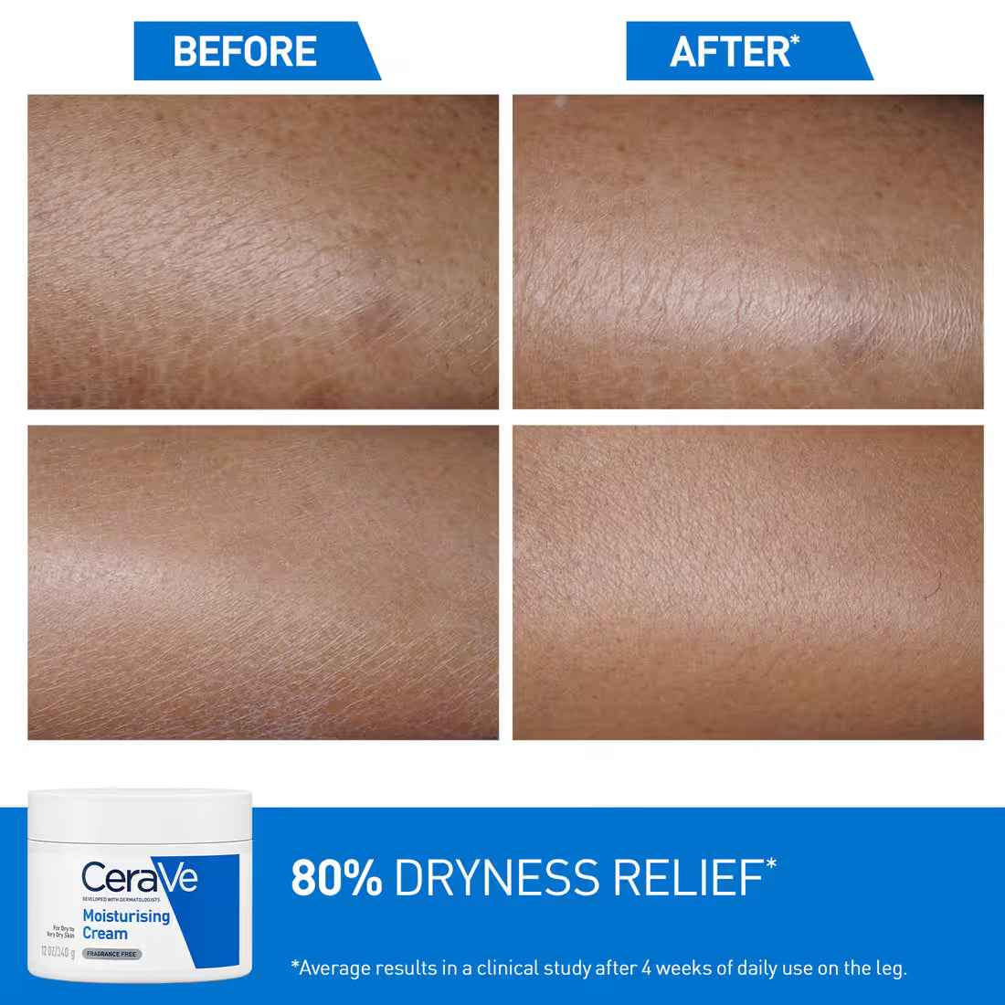 Cera Ve - Moisturising Cream For Dry To Very Dry Skin (340g)