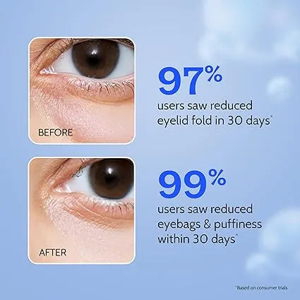 Chemist At Play – 2.5% Quinoa +Ceramides + Green Tea + Postbiotics + Caffeine Under Eye Cream (15g)