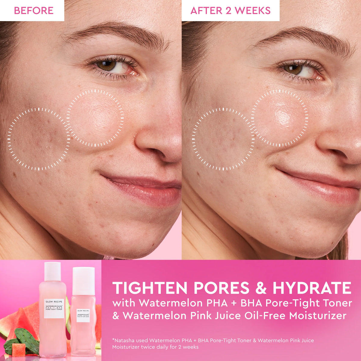 Glow Recipe - Watermelon Glow PHA + BHA Pore - Tight Toner (150ML)